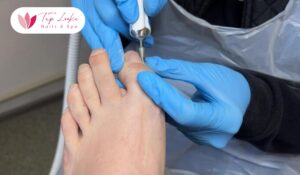 Mobile Nail at Queen Elizabeth II Health Sciences Centre